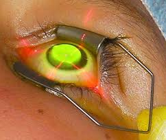 eye treatment