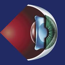 Phakic Intraocular Lenses